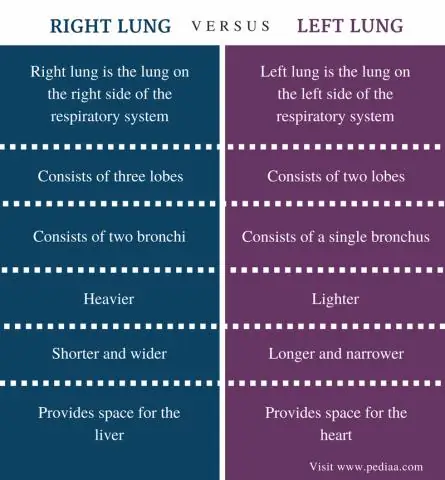 Wat is het verschil tussen linker- en rechtermuisknop?