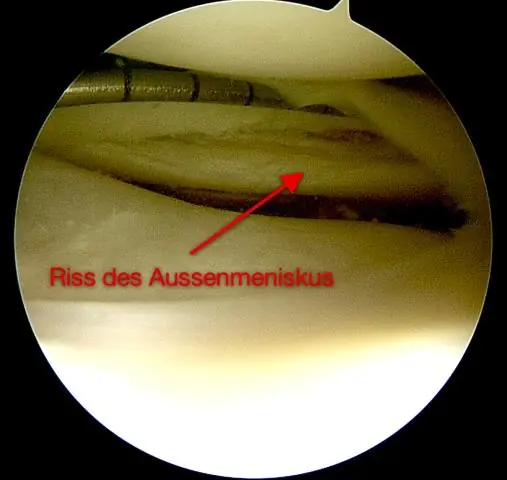 Com diagnostiqueu els problemes de pèrdua de paquets?